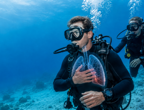 Immersion Pulmonary Oedema in Diving: Causes, Symptoms and Safety Advice